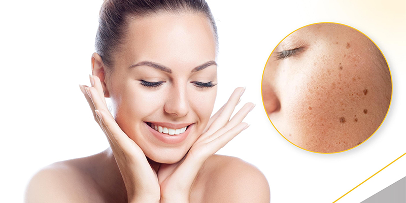 Pigmentation Reduction Treatment