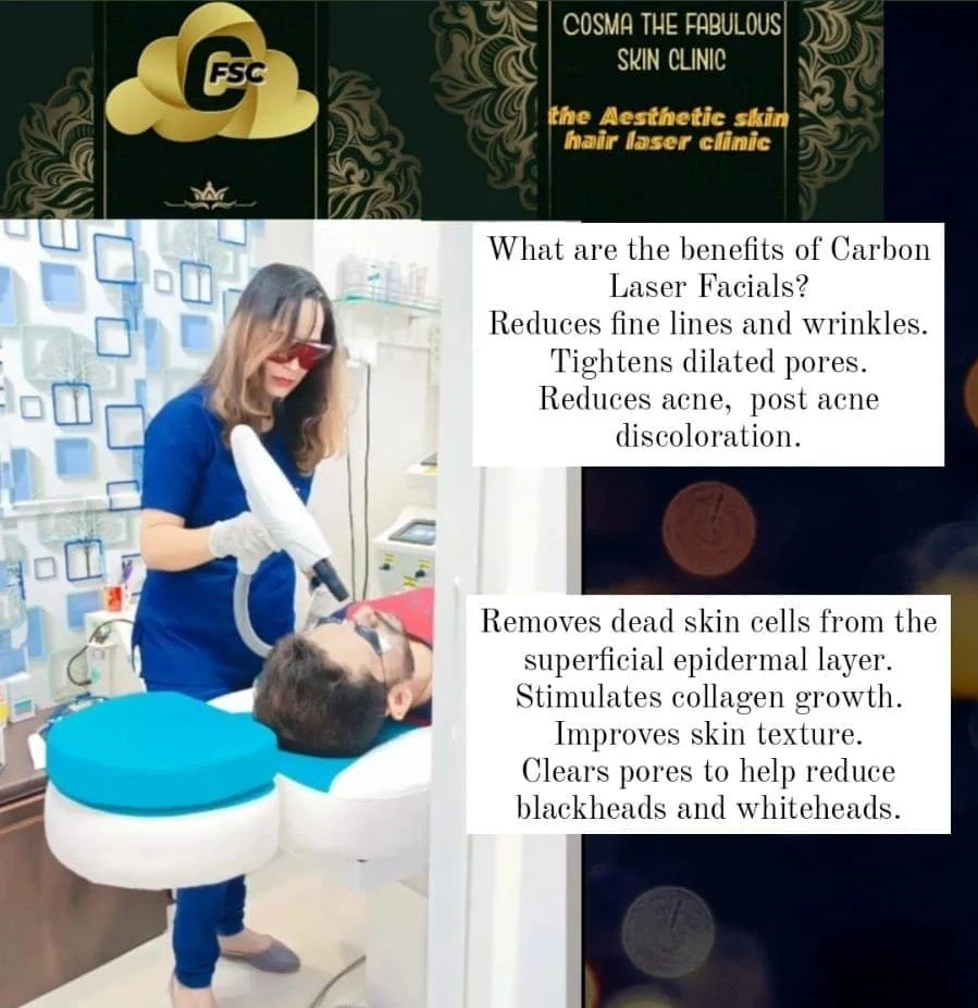 Carbon laser facials